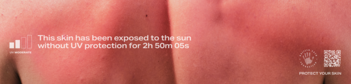 Burnable Billboard Burn